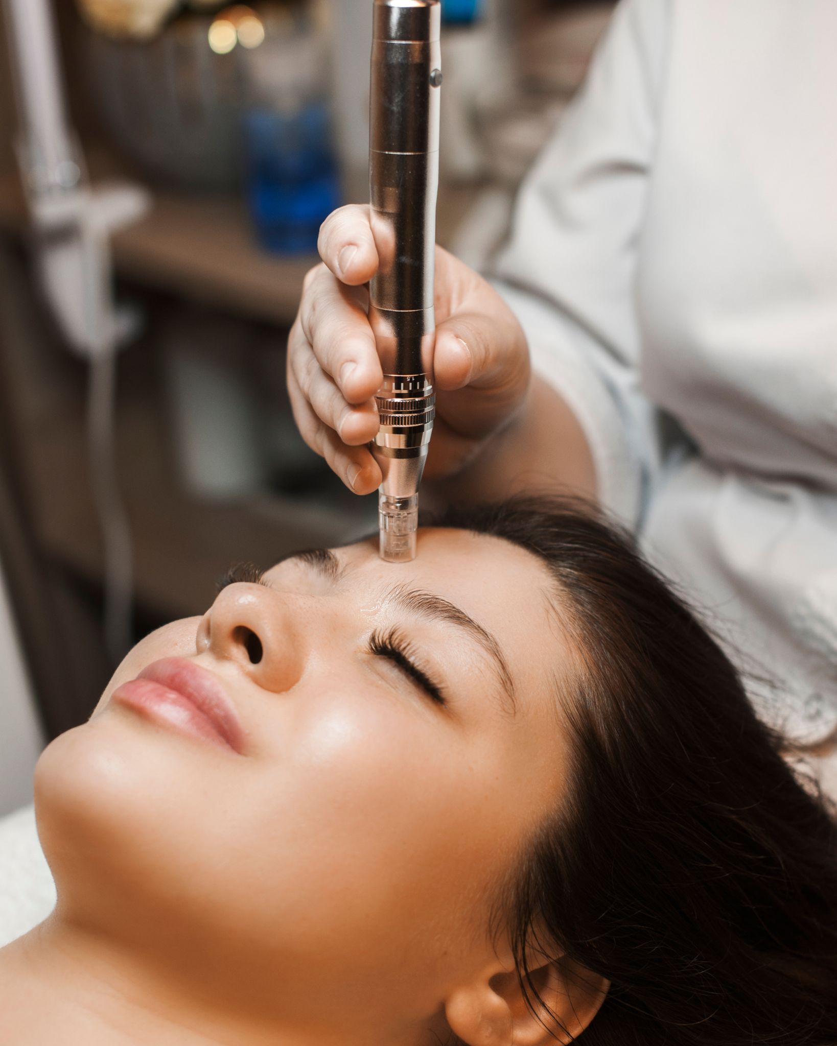 Microneedeling bei Mellos Place in Aalen